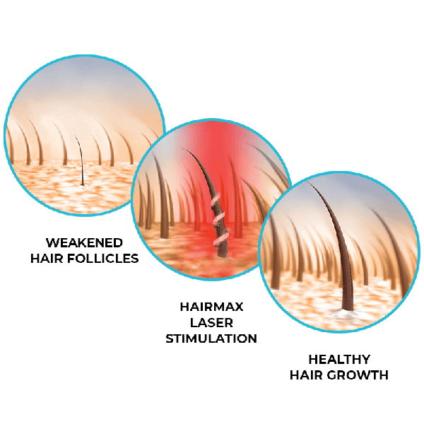 Regrow Laser MD 272